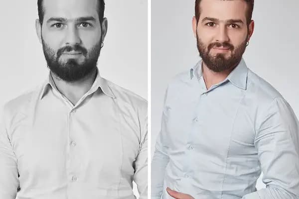 Hairplus Protez Saç Merkezi - ANKARA - Saç Yenileme Hizmeti - Ankara Çankaya