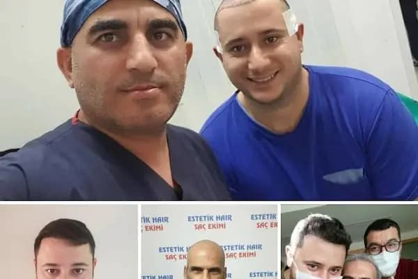 ESTETİK HAİR SAÇ EKİMİ - Saç Transplantasyonu Kliniği - Muğla Fethiye