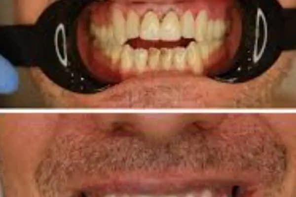 Dentporte Ağız ve Diş Sağlığı Polikliniği - Diş Kliniği - Ankara Altındağ