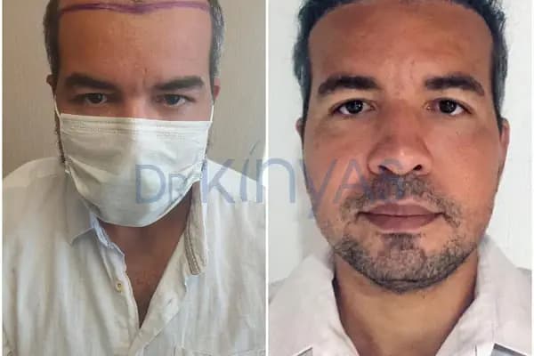 drkinyashairclinic - Saç Transplantasyonu Kliniği - İstanbul Kadıköy