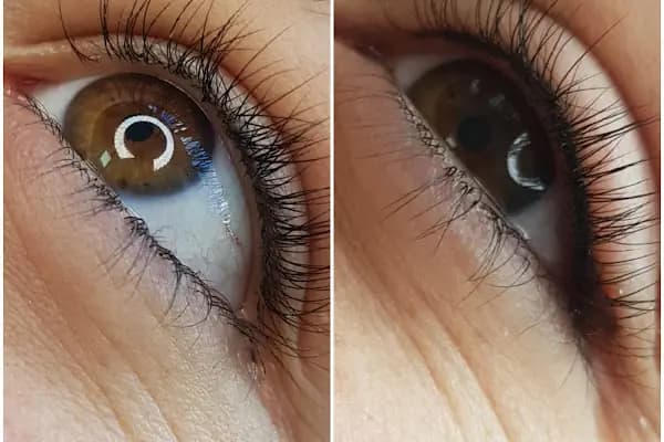 Henna Güzellik Salonu - Lazer Epilasyon Hizmeti - Gaziantep Şehitkamil