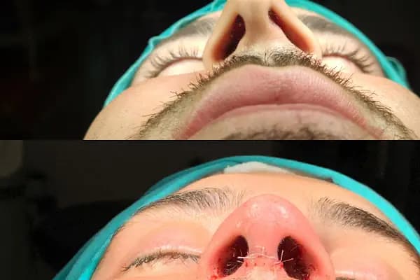 Op. Dr. Ahmet Akatekin Muayenehanesi - Konya Burun Estetiği, Estetik Cerrah Konya - Estetik Cerrahi Kliniği - Konya Karatay