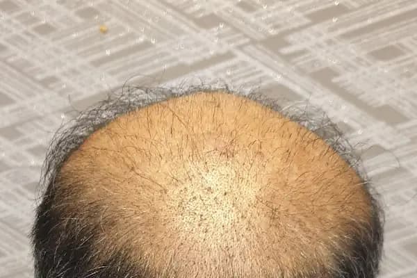 Clinicexpert - Estetik Cerrahi Kliniği - İstanbul Büyükçekmece