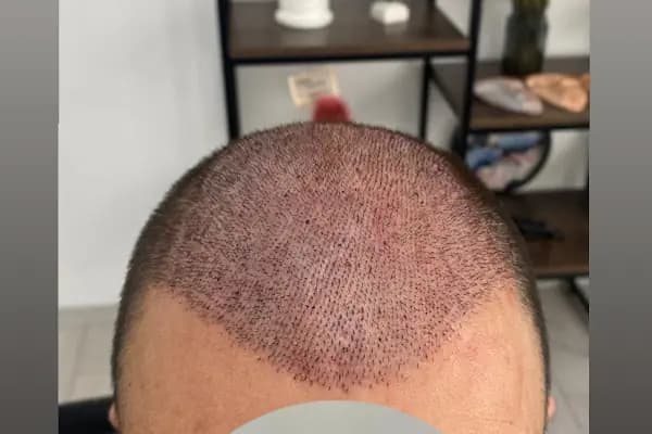 Songül Aktaş Hair &amp; Beauty Center - Sağlık ve Güzellik Merkezi - Muğla Bodrum