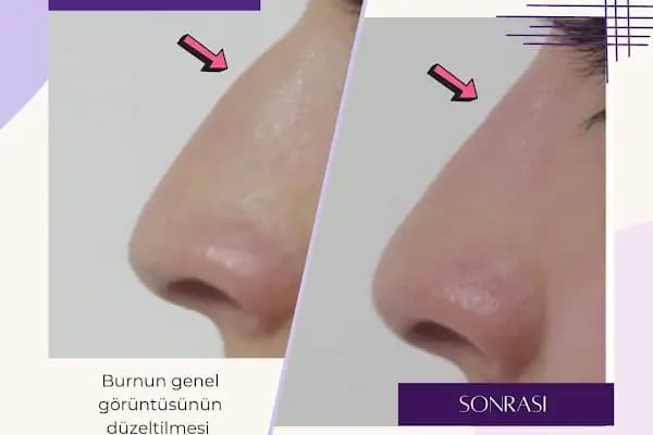 Plastderm - Estetik Cerrahi Kliniği - İstanbul Kartal