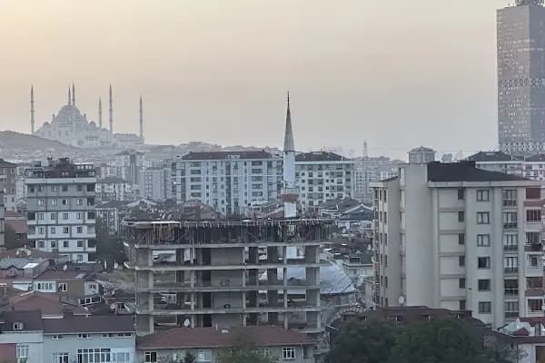 Self Hair Clinic - Saç Ekimi - Hair Transplant Turkey - Saç Transplantasyonu Kliniği - İstanbul Arnavutköy