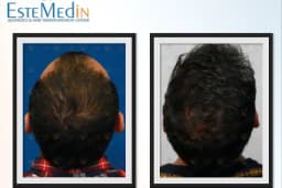 EsteMedin