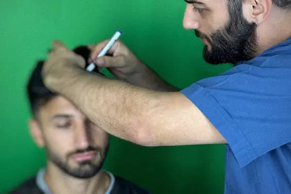 Trabzon Saç Ekim Merkezi - Saç Transplantasyonu Kliniği - Trabzon Ortahisar