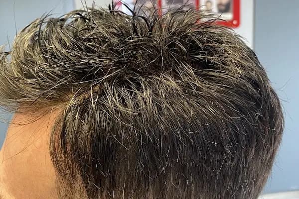 Protez Saç Ankara (Hairlife) - Kuaför - Ankara Çankaya