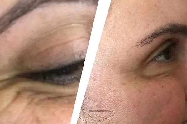 Yeşim armağan medikal estetik - Sağlık ve Güzellik Merkezi - İstanbul Ataşehir