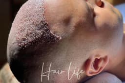 Hair Life Saç Ekim Merkezi