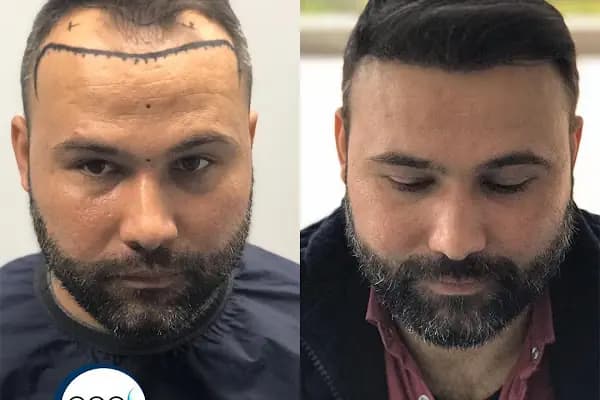 DR. BABACAN Medikal Estetik Saç Ekim&amp;Lazer Epilasyon&amp;Zayıflama - Uzmanlaşmış Klinik - Aydın Kuyucak