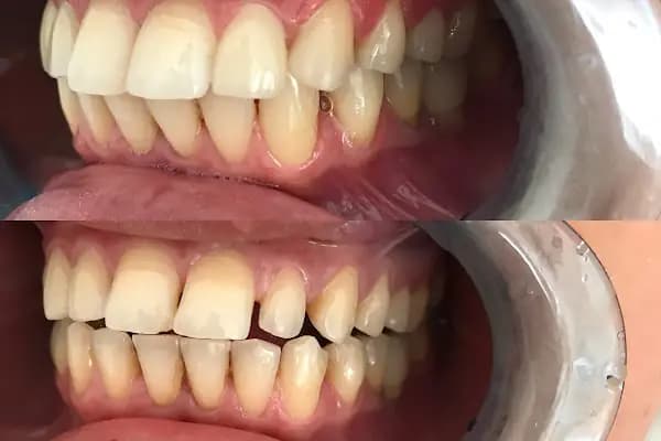 Pident Ağız ve Diş Sağlığı Polikliniği - Diş Hekimi - Gaziantep Nizip