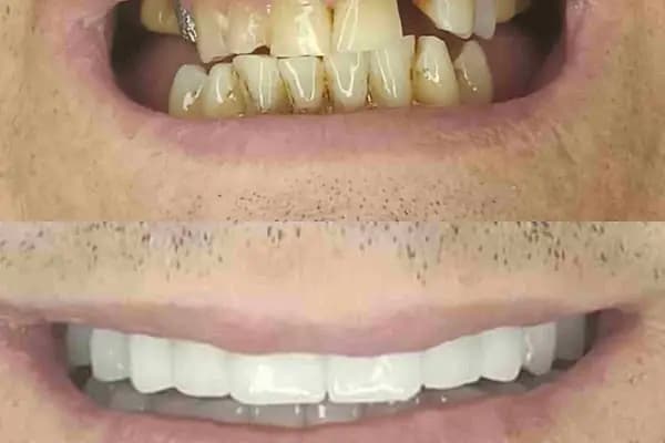 Özel Dicle Dent Diş Kliniği - Diş Hekimi - Diyarbakır Kayapınar