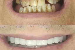 Özel Dicle Dent Diş Kliniği