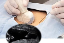 Alanya Perinatoloji - Doç.Dr. Sadettin GÜNGÖR