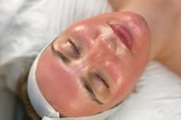 İpek Parsak Güzellik Merkezi - Diode Lazer Epilasyon - Hydrafacial Cilt Bakımı
