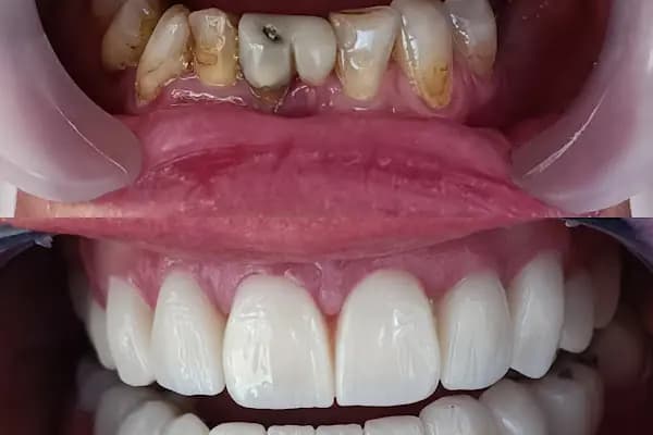 Diş hekimi Mehmet ÖZER-Alanya Diş hekimi -Diş kliniği-İmplant -Zirkonyum-Acil Diş-Kanal Tedavisi-Porselen kaplama-Dentist- - Diş Kliniği - Antalya Kumluca