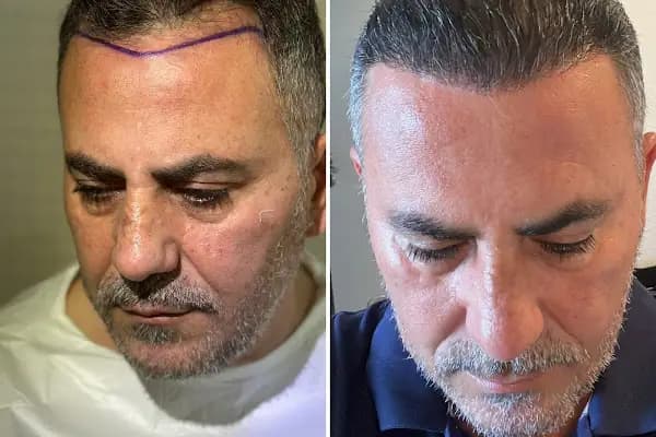 Clean Hair Diyarbakır - Sağlık Danışmanı - Diyarbakır Bismil