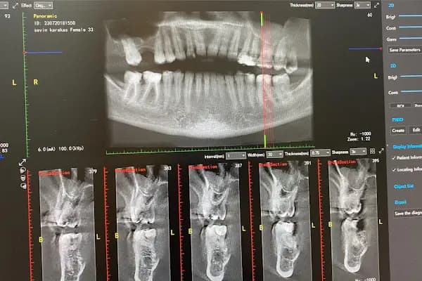 DİŞ HEKİMİ MÜGE AKTAŞ GÜLTEKIN- DİŞ HEKİMİ ATAMAN ÖZGEN GÜLTEKİN - Diş Kliniği - İzmir Narlıdere