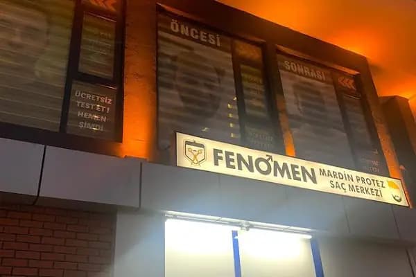 Fenomen Mardin Protez Saç Merkezi - Kuaför - Mardin Artuklu