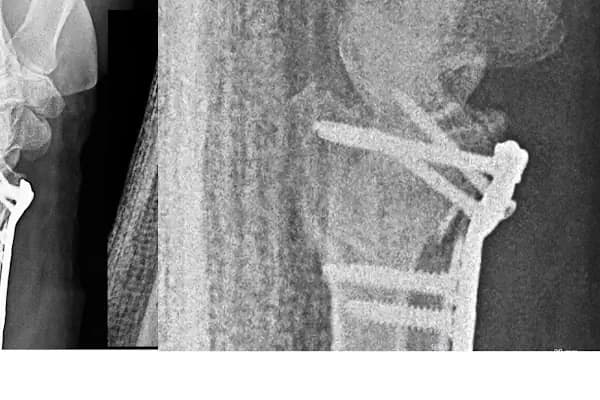Operatör Doktor Tarık Alphan Ortopedi ve Travmatoloji - Ortopedi Kliniği - İzmir Bornova