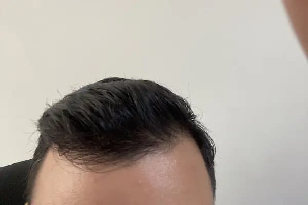 Data Hair Clinic &amp; Eyyüp Tütüncü Saç Ekim Merkezi - Saç Transplantasyonu Kliniği - İstanbul Ümraniye