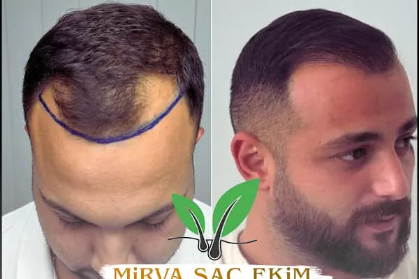 Hifa'M Beauty Center - Güzellik Salonu - Şanlıurfa Bozova