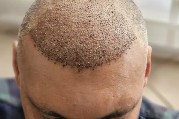 Alanya Estetik Op. Dr. Selahaddin ASLAN - Estetik Cerrahi Kliniği - Antalya Konyaaltı