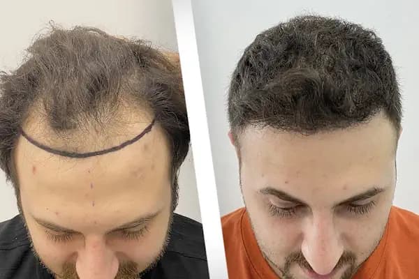 viaTurka İstanbul Medical Aesthetics, Dental &amp; Hair Transplant - Sağlık Hizmetleri Ofisi - İstanbul Ataşehir