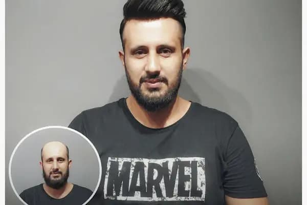 Magic Hair Protez Saç Merkezi - Saç Yenileme Hizmeti - İstanbul Tuzla