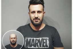Magic Hair Protez Saç Merkezi