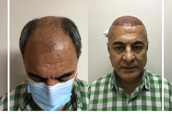 Estetik &amp; güzellik Şanliurfa Saç Ekim Merkezi /زراعة الشعر في أورفا - Sağlık ve Güzellik Merkezi - Gaziantep Şehitkamil