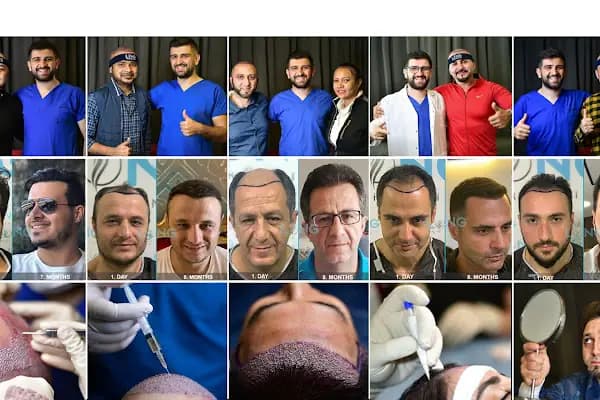 Long Hair Center Istanbul (LHC CLINIC) - Saç Transplantasyonu Kliniği - İstanbul Beylikdüzü