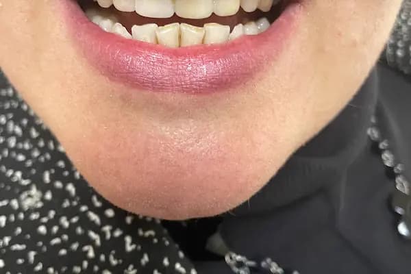 Diş Hekimi Hasibe Şahin - Diş Kliniği - Bursa Osmangazi