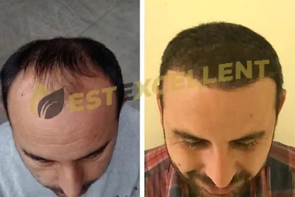 Estexcellent - Sağlık ve Güzellik Merkezi - İstanbul Ataşehir