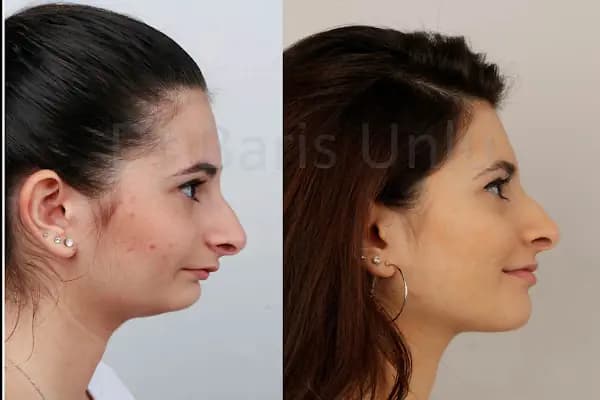 Pixl Aesthetic &amp; Hair Services - Estetik Cerrahi Kliniği - İstanbul Ataşehir