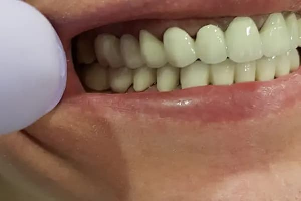 İstanbul bağcılar güngören bahçelievler acil diş estetica - Diş Kliniği - İstanbul Bağcılar