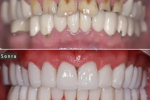 Diş Hekimi Dt. Aysun YILDIZHAN Ağız ve Diş Sağlığı Kliniği - Diş Kliniği - Adana Karataş