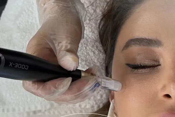 S Clinic Samsun - Saç Çoğaltma, Saç Bakım ve Güzellik Merkezi - Saç Yenileme Hizmeti - Samsun İlkadım