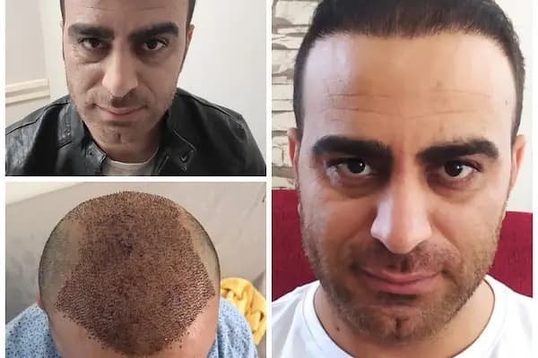 Serap Lazer Epilasyon &amp; Güzellik Salonu Birecik - Güzellik Salonu - Gaziantep Nizip