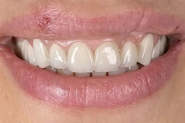 ÖZEL ÖZER DENT AĞIZ VE DİŞ SAĞLIĞI POLİKLİNİĞİ - Diş Kliniği - Gaziantep Şehitkamil