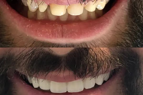 Özel Bursa Uzmanlar Ağız ve Diş Sağlığı - Diş Kliniği - Bursa Nilüfer