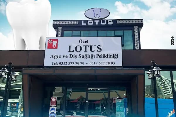 Lotus Ağız ve Diş Sağlığı Polikliniği - Diş Kliniği - Ankara Altındağ