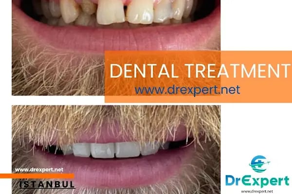 Dr Expert Turkey - Resim 3