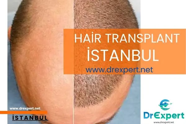 Dr Expert Turkey - Resim 5