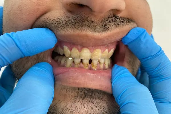 Özel Avrupadent Çiğli Ağız ve Diş Sağlığı Polikliniği - Resim 5