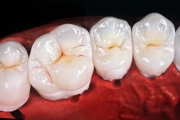 AYVALI AĞIZ VE DİŞ SAĞLIĞI POLİKLİNLİĞİ - Resim 6