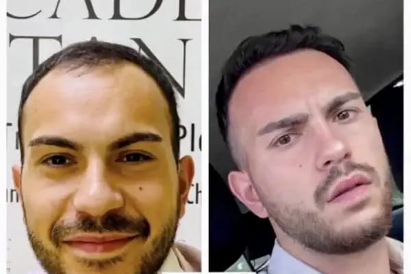 Academic İstanbul Saç Ekim - Resim 13