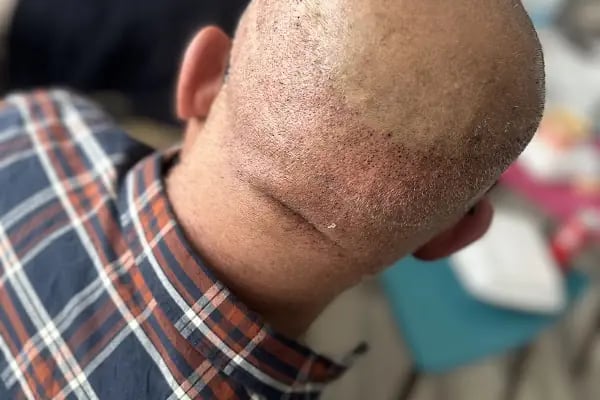 Op. Dr. Mehmet Çelik &amp; Aesthetic Surgery - Resim 2